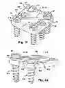 Fig. 08 - ORTHOPAEDIC FIXATION APPARATUS AND METHOD