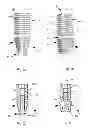 Fig. 03 - Endosseous implant having improved anchorage