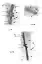 Fig. 09 - Endosseous implant having improved anchorage