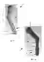 Fig. 10 - Endosseous implant having improved anchorage
