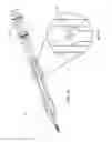 Fig. 12 - Spinal implant system and method