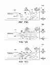 Fig. 10 - External defibrillator electrode, method and system for reducing ECG artifact