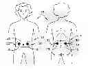 Fig. 01 - Transcutaneous stimulation method and system