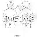 Fig. 02 - Transcutaneous stimulation method and system