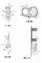 Fig. 06 - Intravascular electrode system and method