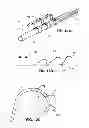 Fig. 12 - Intravascular electrode system and method