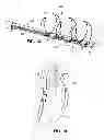 Fig. 13 - Intravascular electrode system and method
