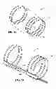 Fig. 15 - Intravascular electrode system and method