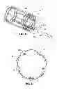 Fig. 16 - Intravascular electrode system and method