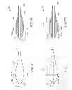 Fig. 06 - Distal tip for a delivery catheter