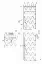 Fig. 04 - Delivery systems for delivering and deploying stent grafts