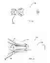 Fig. 10 - Delivery systems for delivering and deploying stent grafts