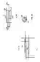Fig. 15 - Delivery systems for delivering and deploying stent grafts