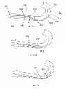 Fig. 24 - Delivery systems for delivering and deploying stent grafts