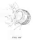Fig. 25 - Delivery systems for delivering and deploying stent grafts