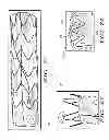 Fig. 27 - Delivery systems for delivering and deploying stent grafts