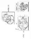 Fig. 28 - Delivery systems for delivering and deploying stent grafts