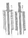 Fig. 33 - Delivery systems for delivering and deploying stent grafts