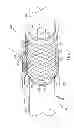 Fig. 07 - Rotating stent delivery system for side branch access and protection and method of using same