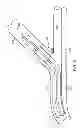 Fig. 09 - Rotating stent delivery system for side branch access and protection and method of using same