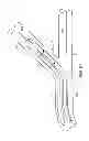 Fig. 10 - Rotating stent delivery system for side branch access and protection and method of using same