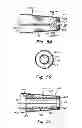 Fig. 03 - Medical device delivery