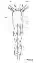 Fig. 05 - Assembly of stent grafts with diameter reducing ties