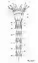 Fig. 06 - Assembly of stent grafts with diameter reducing ties