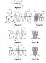 Fig. 08 - Assembly of stent grafts with diameter reducing ties