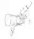 Fig. 02 - METHOD AND APPARATUS FOR INSERTING A FILLED PROSTHETIC BLADDER INTO A PATIENT