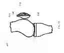 Fig. 12 - Patella implant systems and patella trials for selecting same