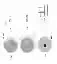 Fig. 13 - Patella implant systems and patella trials for selecting same