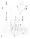 Fig. 16 - Patella implant systems and patella trials for selecting same