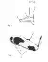 Fig. 02 - Scanner-Assisted Selection of Fitting Footwear with Individualized Footbed