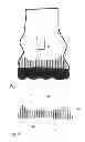 Fig. 03 - Scanner-Assisted Selection of Fitting Footwear with Individualized Footbed