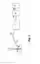 Fig. 03 - Method for detecting flaws in the process for the continuous laser welding of metallic portions