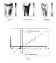 Fig. 07 - System to evaluate prosthetic sockets