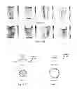 Fig. 12 - System to evaluate prosthetic sockets