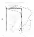Fig. 06 - Presentation of image on display screen with combination crop and rotation and with auto-resizing of crop field