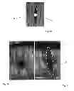 Fig. 02 - TOOL FOR INJECTION OR INFUSION INTO TREES OR SHRUBS
