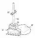 Fig. 01 - Portable trash bag support