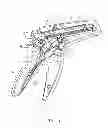 Fig. 05 - Method and force-limiting handle mechanism for a surgical instrument