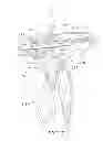 Fig. 08 - Method and force-limiting handle mechanism for a surgical instrument