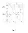 Fig. 29 - System for providing flow-targeted ventilation synchronized to a patients breathing cycle