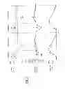 Fig. 31 - System for providing flow-targeted ventilation synchronized to a patients breathing cycle