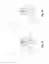 Fig. 11 - AIRWAY PRESSURE CONTROL DEVICES WITH FLUTTER VALVE