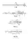 Fig. 09 - Medical devices and methods of making and using such devices