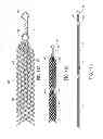 Fig. 13 - Medical devices and methods of making and using such devices