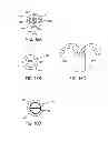 Fig. 22 - Medical devices and methods of making and using such devices