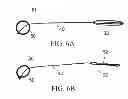 Fig. 07 - Devices And Methods For Treating Sleep Disordered Breathing
